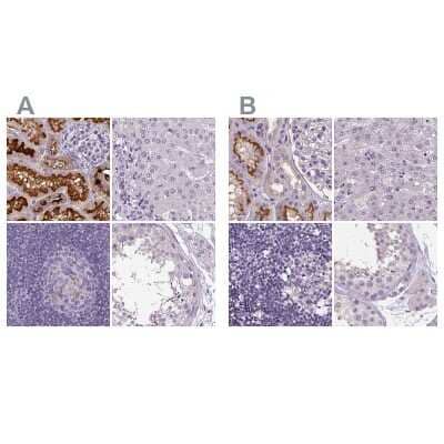 Immunohistochemistry-Paraffin: ATP6V1D Antibody [NBP1-88895]