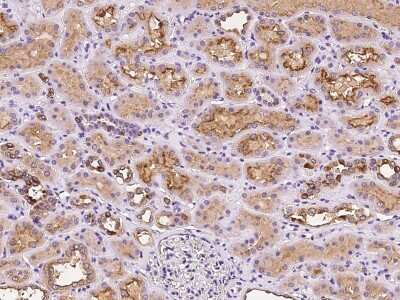 Immunohistochemistry-Paraffin: ATP6V1D Antibody [NBP2-97189]