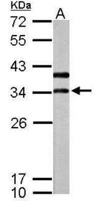 Western Blot: ATP6V1D Antibody [NBP2-15518]