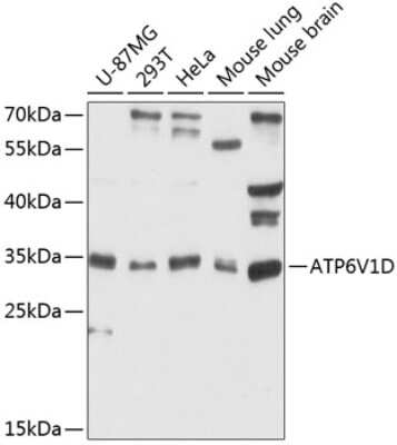 Western Blot: ATP6V1D AntibodyAzide and BSA Free [NBP2-92709]