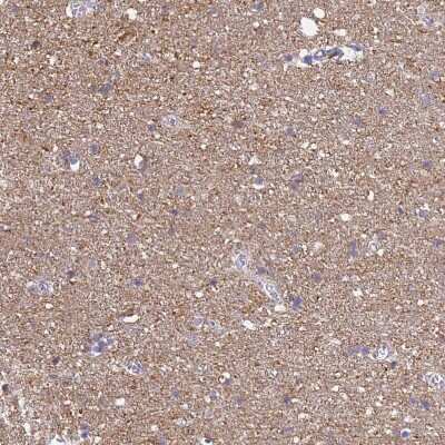 Immunohistochemistry-Paraffin: ATP6V1E1 Antibody [NBP2-14335]