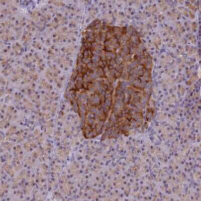 Immunohistochemistry-Paraffin: ATP6V1E1 Antibody [NBP2-14335]