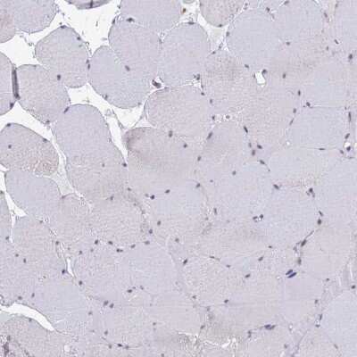 Immunohistochemistry-Paraffin: ATP6V1E1 Antibody [NBP2-14335]