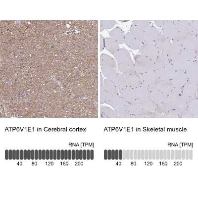Immunohistochemistry-Paraffin: ATP6V1E1 Antibody [NBP2-14335]