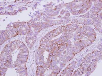 Immunohistochemistry-Paraffin: ATP6V1E1 Antibody [NBP2-15520]