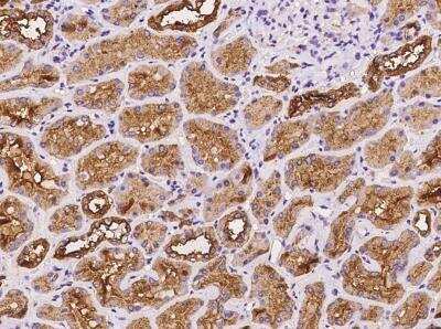 Immunohistochemistry-Paraffin: ATP6V1E1 Antibody [NBP3-06402]
