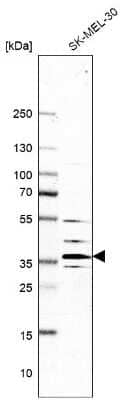 Western Blot: ATP6V1E1 Antibody [NBP2-14335]