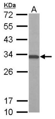 Western Blot: ATP6V1E1 Antibody [NBP2-15519]