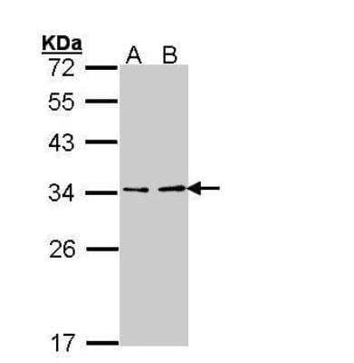 Western Blot: ATP6V1E1 Antibody [NBP2-15519]