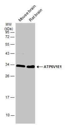 Western Blot: ATP6V1E1 Antibody [NBP2-15520]