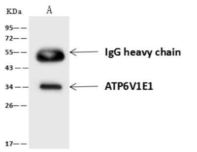 Western Blot: ATP6V1E1 Antibody [NBP3-06402]