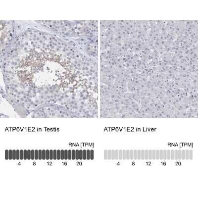 Immunocytochemistry/ Immunofluorescence: ATP6V1E2 Antibody [NBP3-17046]