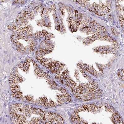 Immunohistochemistry-Paraffin: ATP6V1E2 Antibody [NBP2-49059]