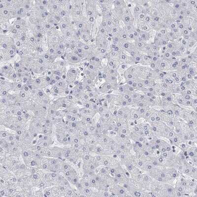 Immunohistochemistry-Paraffin: ATP6V1E2 Antibody [NBP3-17046]