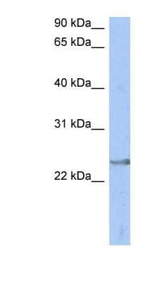 Western Blot: ATP6V1E2 Antibody [NBP1-54601]