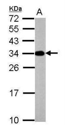 Western Blot: ATP6V1E2 Antibody [NBP2-15521]