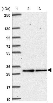 Western Blot: ATP6V1E2 Antibody [NBP2-49059]