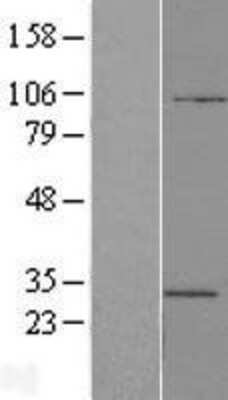 Western Blot: ATP6V1E2 Overexpression Lysate [NBL1-07844]