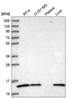 Western Blot: ATP6V1G1 Antibody [NBP2-55232]