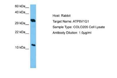 Western Blot: ATP6V1G1 Antibody [NBP2-84484]