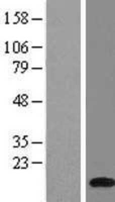 Western Blot: ATP6V1G1 Overexpression Lysate [NBL1-07846]