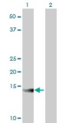 Western Blot: ATP6V1G2 Antibody (2E11) [H00000534-M02]