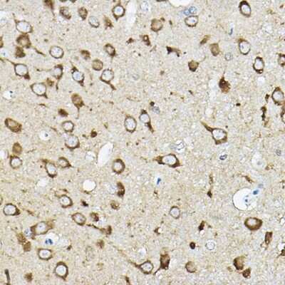 Immunohistochemistry-Paraffin: ATP6V1G2 Antibody - Azide and BSA Free [NBP3-15964]