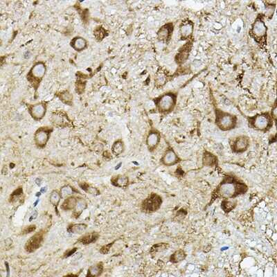 Immunohistochemistry-Paraffin: ATP6V1G2 Antibody - Azide and BSA Free [NBP3-15964]