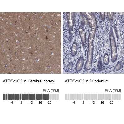 Immunohistochemistry-Paraffin: ATP6V1G2 Antibody [NBP3-17121]