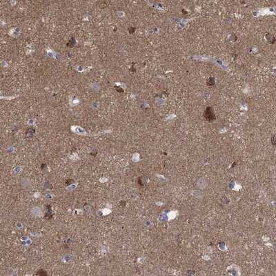 Immunohistochemistry-Paraffin: ATP6V1G2 Antibody [NBP3-17121]