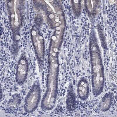 Immunohistochemistry-Paraffin: ATP6V1G2 Antibody [NBP3-17121]