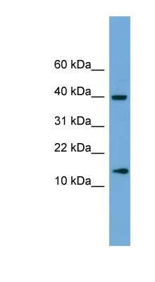 Western Blot: ATP6V1G2 Antibody [NBP1-79685]