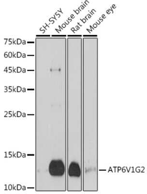 Western Blot: ATP6V1G2 AntibodyAzide and BSA Free [NBP3-15964]