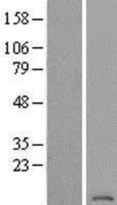 Western Blot: ATP6V1G2 Overexpression Lysate [NBP2-05681]