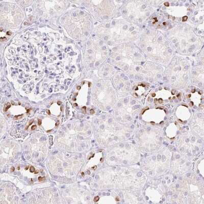 Immunohistochemistry-Paraffin: ATP6V1G3 Antibody [NBP1-88894]