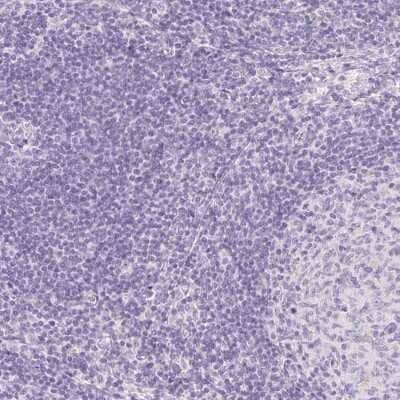 Immunohistochemistry-Paraffin: ATP6V1G3 Antibody [NBP1-88894]