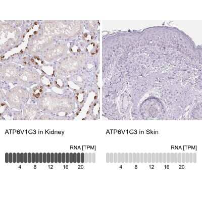 Immunohistochemistry-Paraffin: ATP6V1G3 Antibody [NBP1-88894]