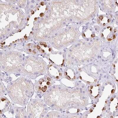 Immunohistochemistry-Paraffin: ATP6V1G3 Antibody [NBP1-88894]