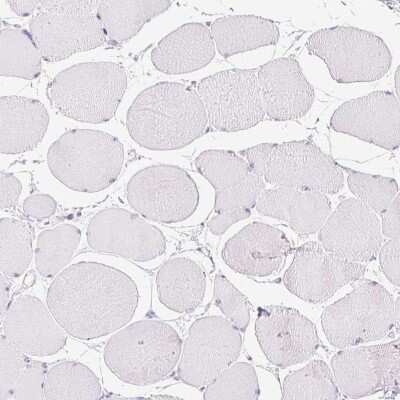 Immunohistochemistry-Paraffin: ATP6V1G3 Antibody [NBP1-88894]