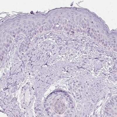 Immunohistochemistry-Paraffin: ATP6V1G3 Antibody [NBP1-88894]