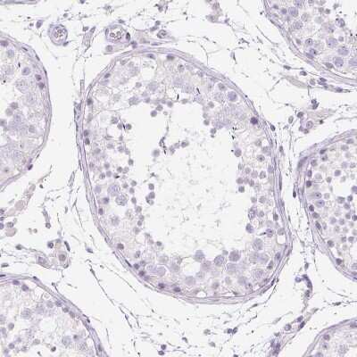 Immunohistochemistry-Paraffin: ATP6V1G3 Antibody [NBP1-88894]