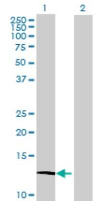 Western Blot: ATP6V1G3 Antibody [H00127124-B01P]