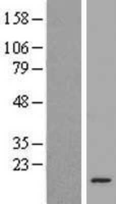 Western Blot: ATP6V1G3 Overexpression Lysate [NBP2-05712]