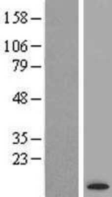 Western Blot: ATP6V1G3 Overexpression Lysate [NBP2-05717]