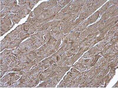 Immunohistochemistry-Paraffin: ATP6V1H Antibody [NBP1-32980]