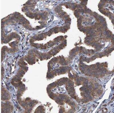 Immunohistochemistry-Paraffin: ATP6V1H Antibody [NBP1-85668]