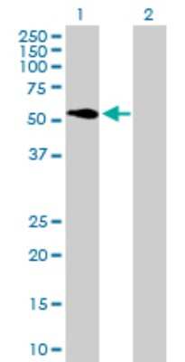 Western Blot: ATP6V1H Antibody [H00051606-B01P]