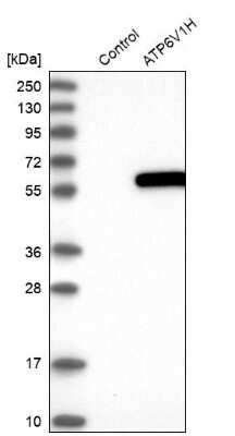 Western Blot: ATP6V1H Antibody [NBP1-85668]