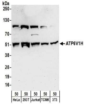 Western Blot: ATP6V1H Antibody [NBP2-32203]