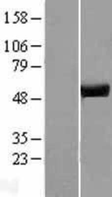 Western Blot: ATP6V1H Overexpression Lysate [NBL1-07847]